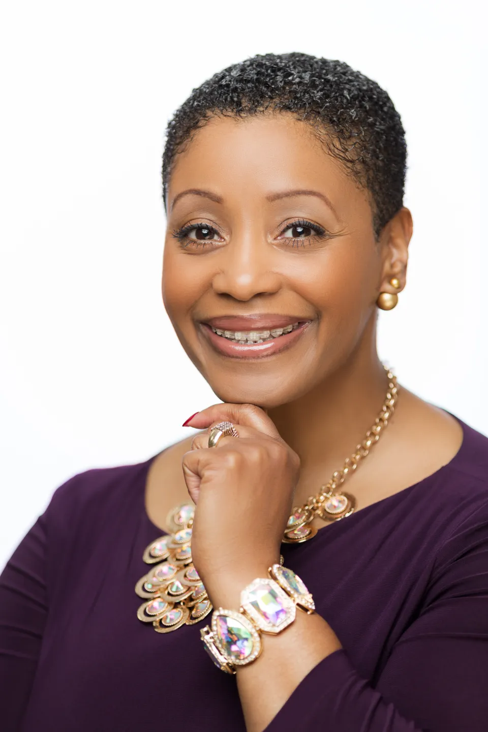 An adult patient smiling with Lightforce clear ceramic braces
