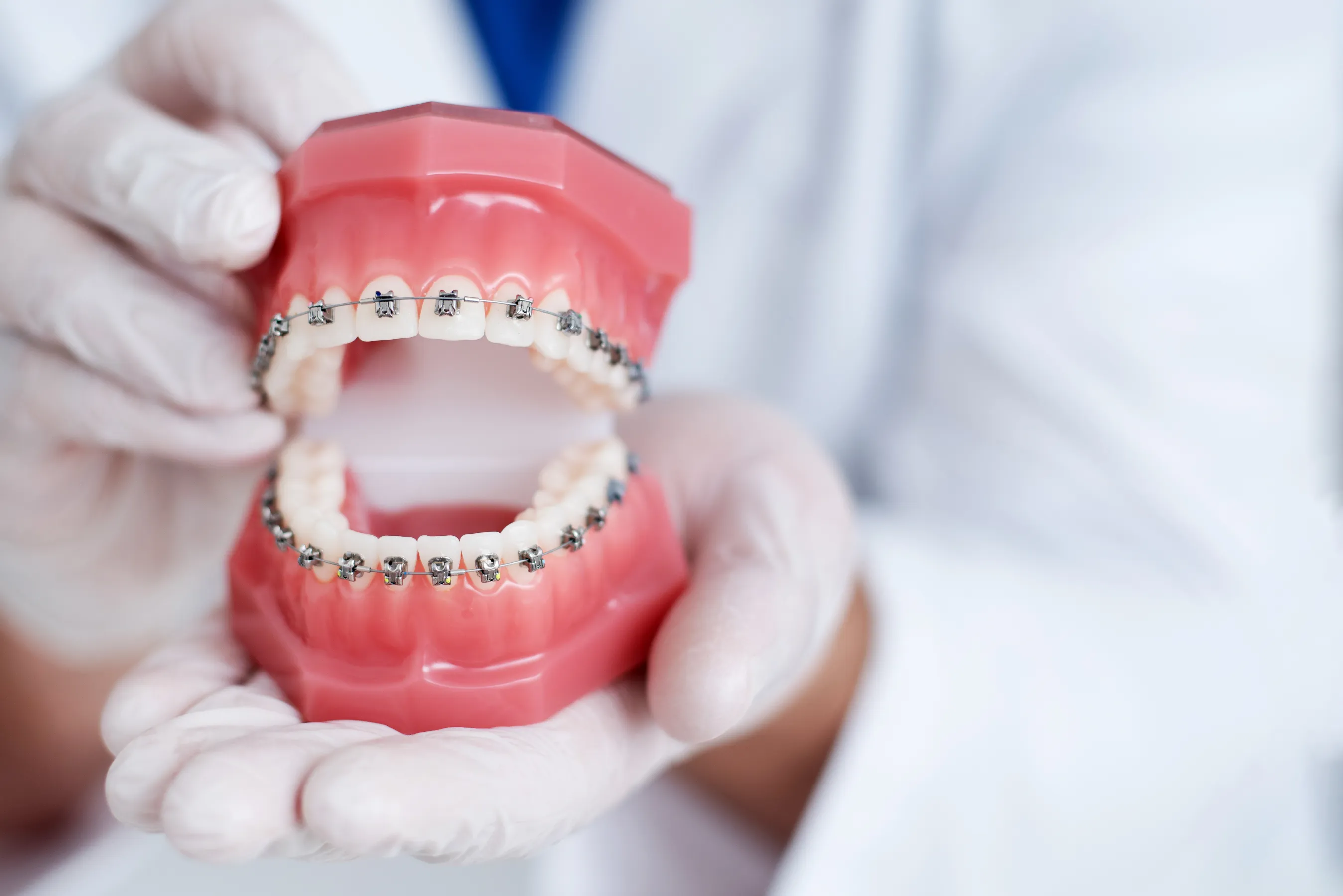 Orthodontic model with braces