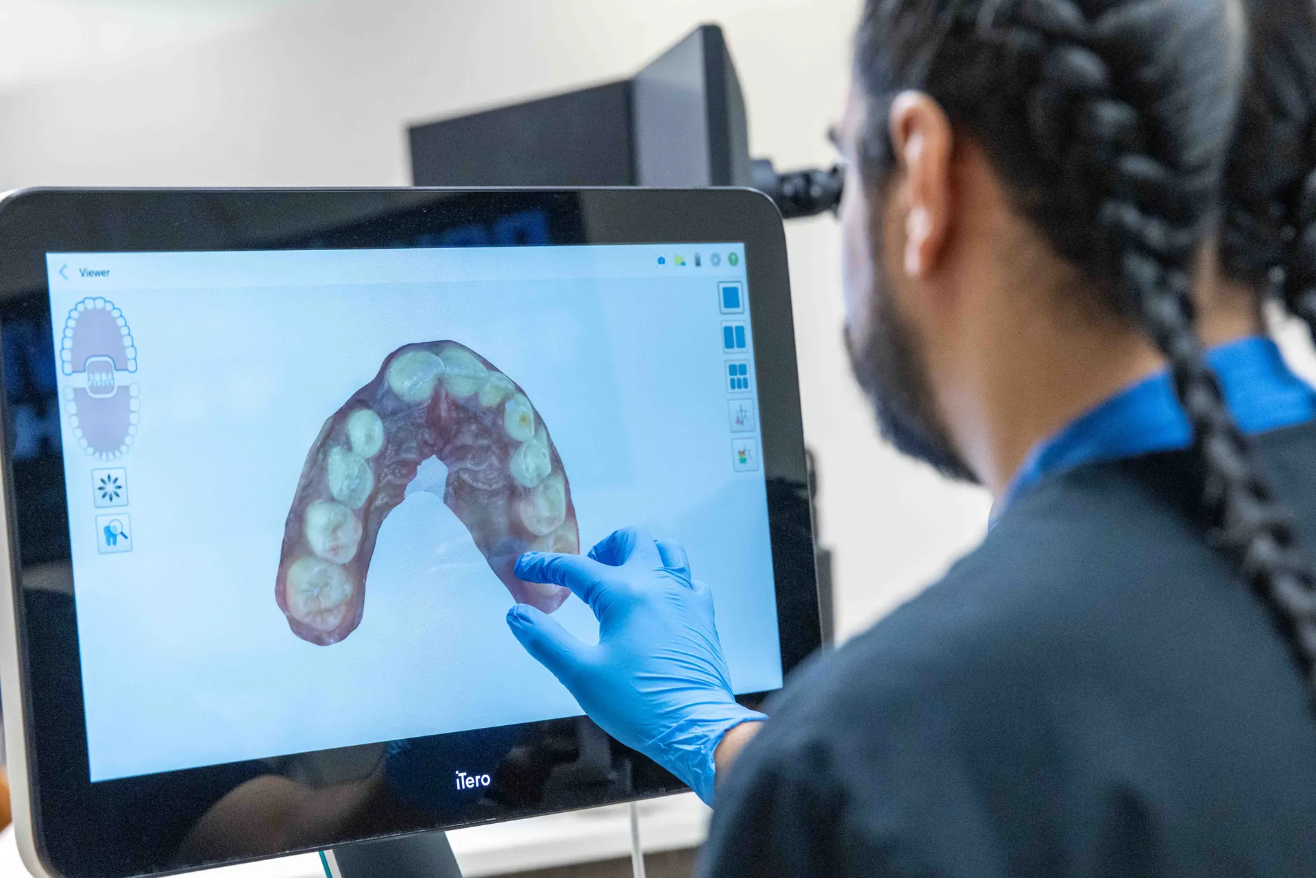 A 3D digital scan of a patient's teeth on the iTero screen at Bowie Braces