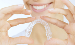 invisalign